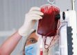 Bloedtransfusie meten met twee maten